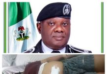 Murder Of Dr. Ferry Gberegbe: No Killer Goes Unpunished, PDP Tells F-SARS Rivers Commander, Akin Fakorede