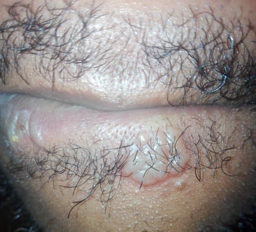 TERRIBLE: What Happened To Me After Sucking Girl’s P*ssy – Man Reveals